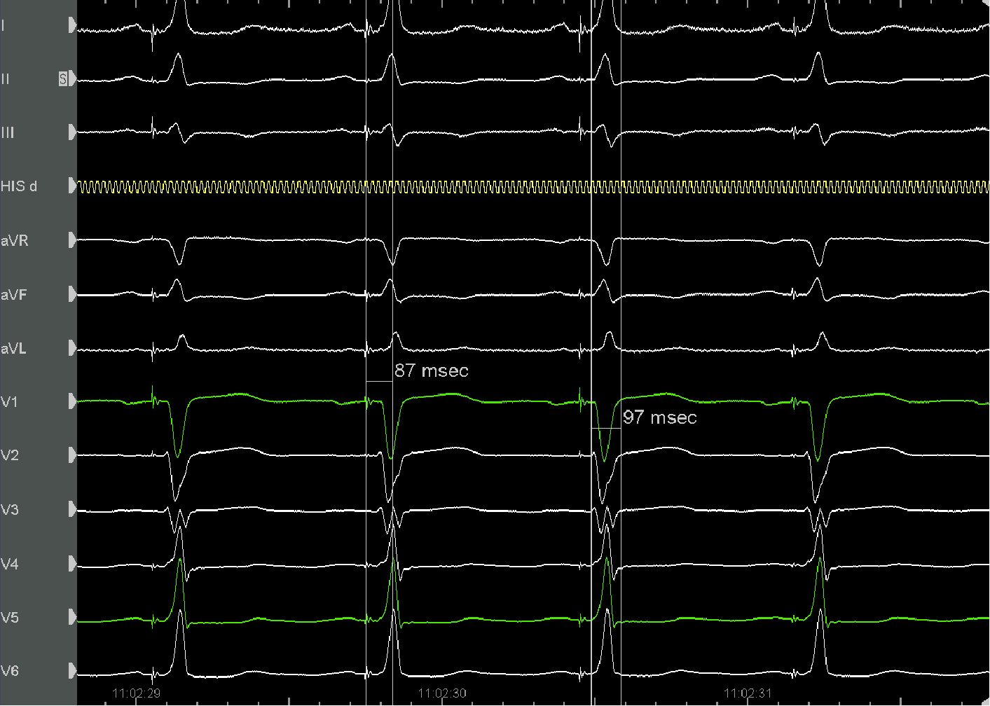 1574740126836078518.png SAV100.png