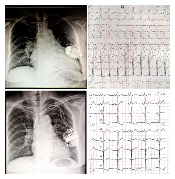 1574740294301035378.png 拼图SHM_副本.png